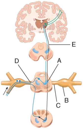 Which of the labeled structures in the diagram of the trigeminothalamic pathway is the trigeminal ganglion?