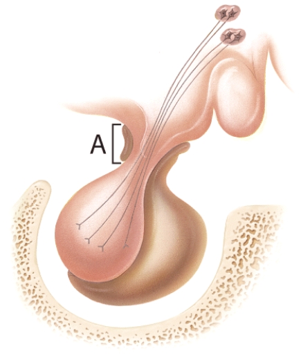 <strong>Identify the stalk-like structure labeled A in the diagram. </strong> A)hypothalamus B)anterior pituitary C)posterior pituitary D)infundibulum E)hypophyseal fossa