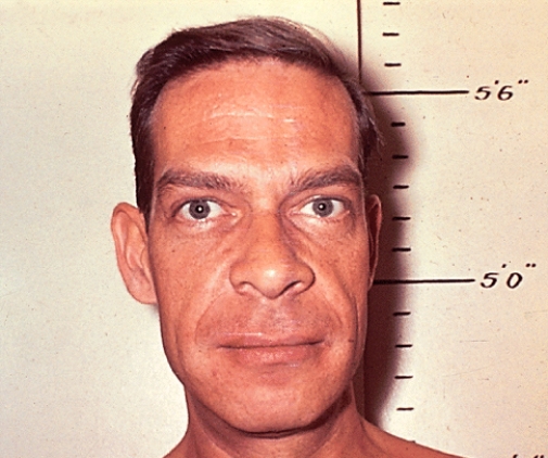 <strong>The patient shown is suffering from a disease called ____________,caused by a pituitary hypersecretion of hGH during adulthood. </strong> A)Goiter B)Graves' Disease C)Acromegaly D)Cushing's syndrome E)Giantism