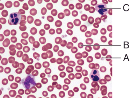 <strong>Which labeled cell in the diagram is a WBC? </strong> A)A B)B C)C D)Both B and C E)All of these choices