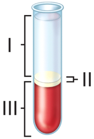 <strong>When blood from a normal adult is centrifuged as shown in the figure,which of the following components occupies the greatest volume? </strong> A)plasma B)red blood cells C)platelets D)buffy coat E)white blood cells