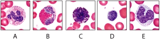 <strong>A high count of which of the white blood cells shown in the figure may indicate cancer or hypothyroidism? </strong> A)A B)B C)C D)D E)E