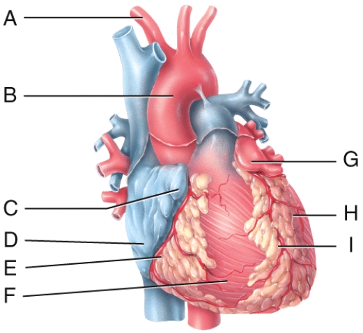 In the diagram,where is the left auricle of the left atrium?