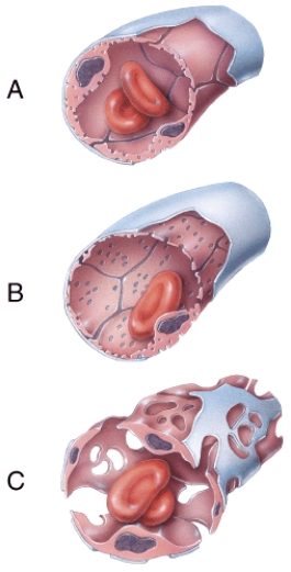 <strong>Which of the capillaries shown in the figure has an incomplete or absent basement membrane? </strong> A)A B)B C)C D)A and B E)A,B,and C