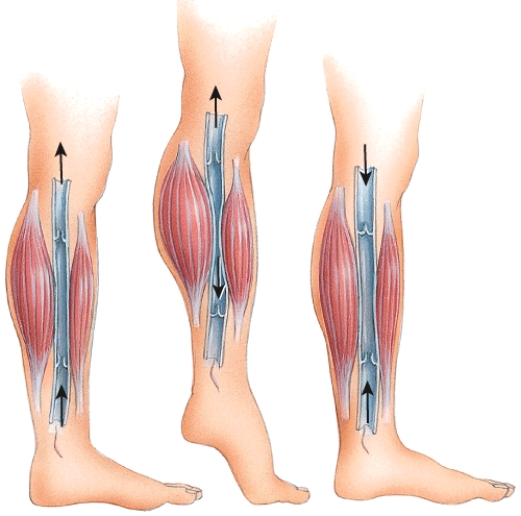 <strong>What physiological process is depicted in this figure? </strong> A)Venous blood blockage B)Skeletal muscle pump C)Respiratory pump D)Thoroughfare channels E)Anastomosis