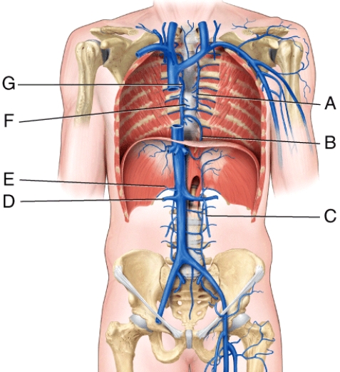 <strong>Which vessel in the figure is labeled F? </strong> A)accessory hemiazygos vein B)hemiazygos vein C)right suprarenal vein D)pericardial vein E)azygos vein