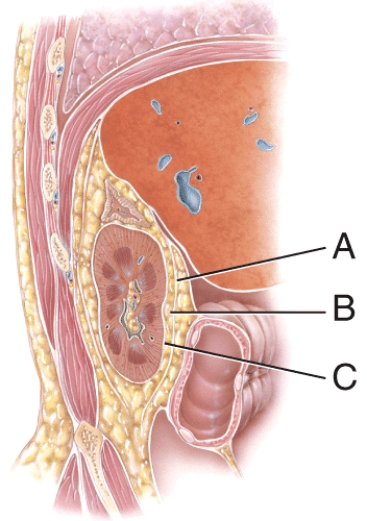 This is composed of dense irregular tissue that runs continuous with the ureter.