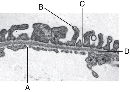 <strong>What is line C pointing to? </strong> A)Fenestration B)Pedicel C)Filtration slit D)Basal lamina E)Lumen of the glomerulus