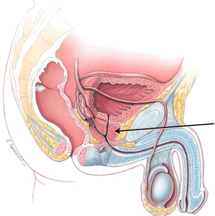 <strong>What is the structure indicated in the figure? </strong> A) urinary bladder B) testis C) bulbourethral gland D) prostate