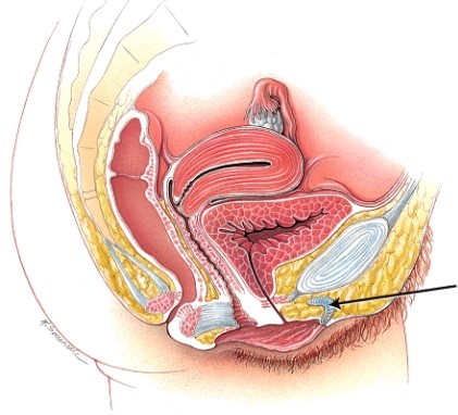 <strong>What structure is indicated in the diagram? </strong> A) ovary B) uterus C) vagina D) clitoris
