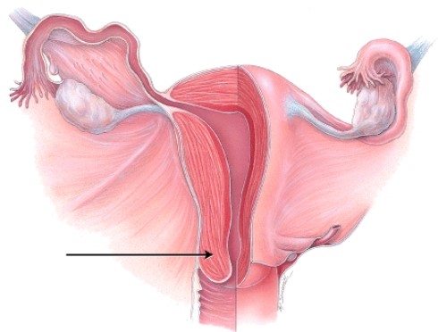 <strong>What is the name of the structure indicated in the diagram? </strong> A) fimbriae of uterine tube B) isthmus of uterine tube C) cervix of uterus D) fundus of uterus