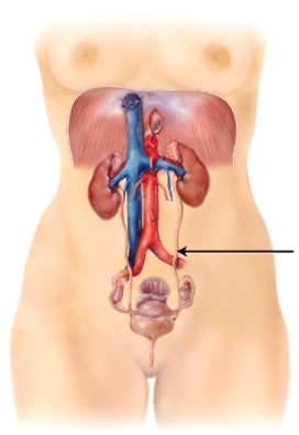 What is the structure that is indicated on the diagram?  