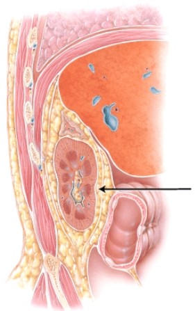 <strong>What structure is the arrow is pointing to? </strong> A) suprarenal gland B) adipose capsule C) quadratus lumborum D) peritoneum