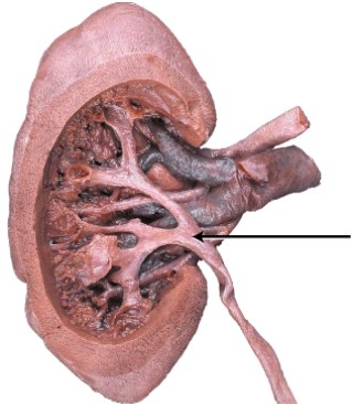 <strong>What is the structure indicated in the diagram? </strong> A) renal pelvis B) minor calyx C) renal vein D) major calyx