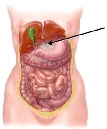 <strong>Identify the structure indicated in the figure.  </strong> A) gallbladder B) sigmoid colon C) greater omentum D) lesser omentum <div style=padding-top: 35px> 