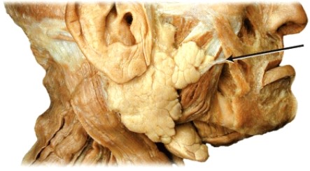 <strong>What structure is the arrow is pointing to?  </strong> A) parotid duct B) mylohyoid duct C) submandibular duct D) sublingual duct <div style=padding-top: 35px> 