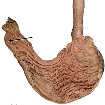 <strong>What is the structure the arrow is pointing to?  </strong> A) rugae B) fundus C) cardia D) pyloric sphincter <div style=padding-top: 35px> 