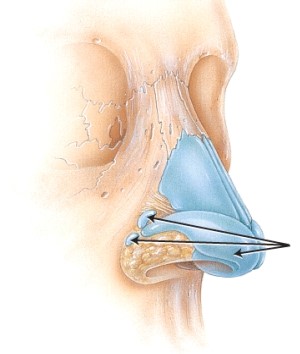<strong>Which cartilages are indicated in the figure? </strong> A) nasal B) lateral C) septal D) alar