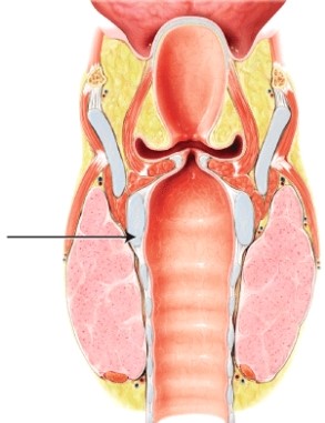 <strong>In this lateral view of the larynx, which cartilage is indicated? </strong> A) epiglottis B) cricoid C) thyroid D) cuneiform