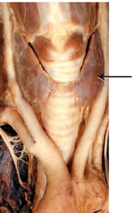 What is the endocrine gland labeled with the arrow?  
