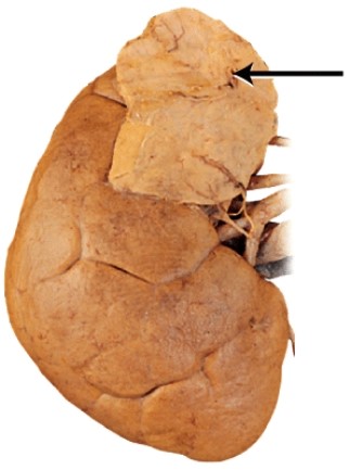 What is the endocrine gland labeled with the arrow?  