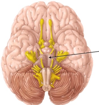 <strong>The structure indicated by the arrow is the _____. </strong> A) pons B) midbrain C) thalamus D) medulla oblongata