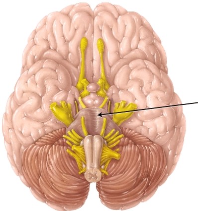 <strong>This structure arises from the _____. </strong> A) telencephalon. B) mesencephalon. C) metencephalon. D) diencephalon.