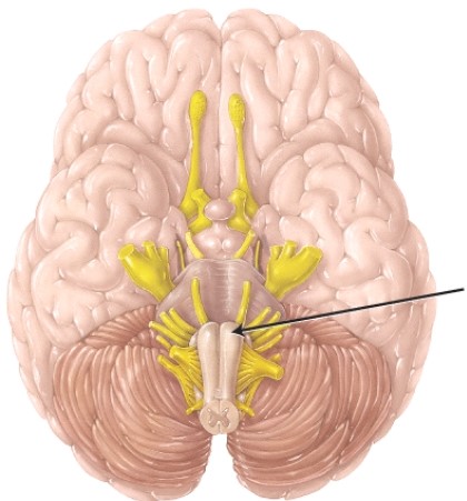 <strong>The structure indicated by the arrow </strong> A) is where the rubrospinal tract begins. B) is where the corticospinal tract decussates. C) is where the spinothalamic tract crosses. D) is where third-order neurons of the posterior (dorsal) column tract originate.