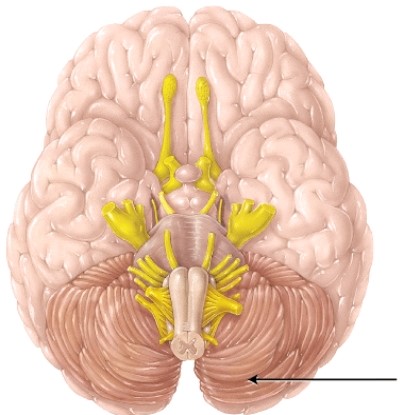 <strong>The structure indicated by the arrow is separated from the occipital lobe of the cerebrum by the </strong> A) transverse fissure B) longitudinal fissure C) central sulcus D) lateral sulcus