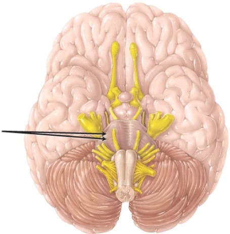 <strong>The structure indicated by the arrows is the </strong> A) cerebral peduncle B) medullary pyramid C) vermis D) cerebellar peduncle
