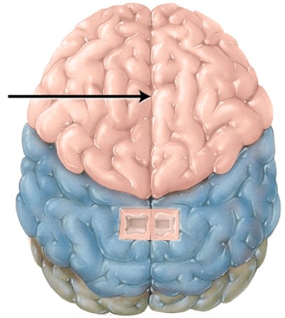 <strong>What collection of commissural fibers is located deep in this structure? </strong> A) association tracts B) corpus callosum C) internal capsule D) projections tracts