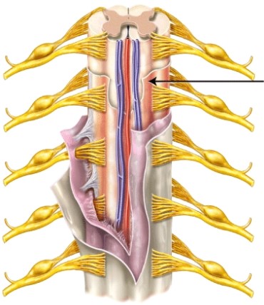 <strong>The meninx indicated by the line is the _____ </strong> A) pia mater B) arachnoid mater C) dura mater