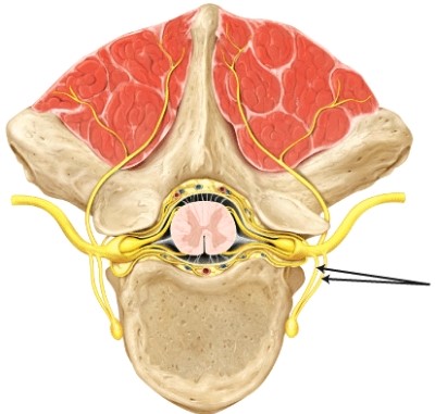 <strong>The structure(s) indicated by the lines is/are the _____ </strong> A) anterior (ventral) ramus B) posterior (dorsal) ramus C) rami communicantes D) posterior (dorsal) root