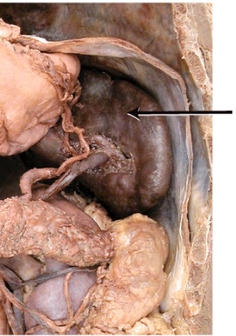 The parenchyma (functional portion) of this organ is comprised of _____ (lymphatic tissue) and _____ (blood-filled sinuses).