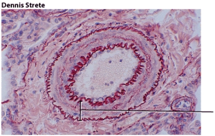 <strong>This blood vessel tissue layer is most responsible for: </strong> A) regulating blood flow and blood pressure B) helping to limit the loss of blood when vessels are damaged C) regulating the diameter of the lumen wall D) ALL of these choices