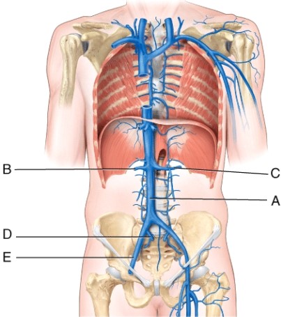 <strong>The left testicular (or ovarian) vein drains into the _____, whereas the right testicular (or ovarian) vein drains into the _____. </strong> A) A; B B) B; C C) D; E D) C; A
