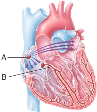 Match the component of the conduction system of the heart with the description. Sinoatrial (SA) node: