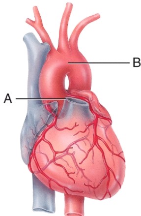 <strong>Match the vessel with the description. Pulmonary trunk:  </strong> A) carries deoxygenated blood away from the heart B) carries deoxygenated blood toward the heart <div style=padding-top: 35px> 