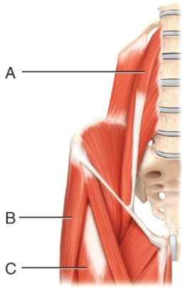 <strong>The muscle indicated by line A is the </strong> A) Psoas major B) Gracilis C) Obturator externus D) Iliacus
