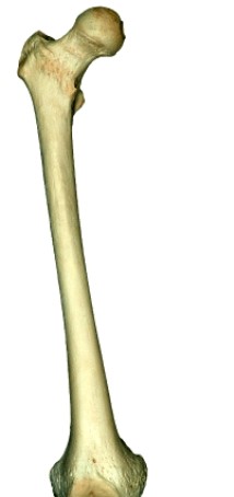 Visible in this view of the femur is/are the  