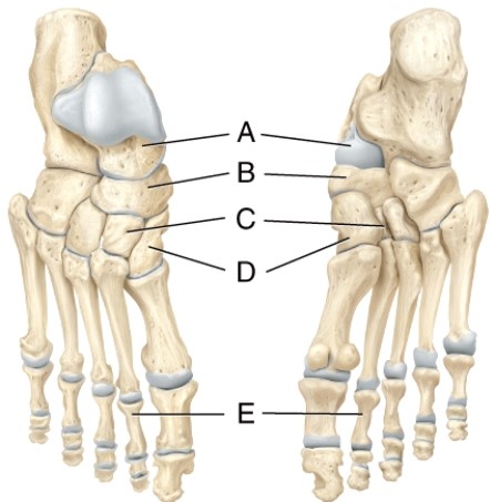 Identify the navicular bone.  