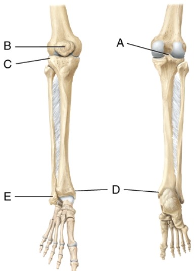 Identify the medial malleolus.  
