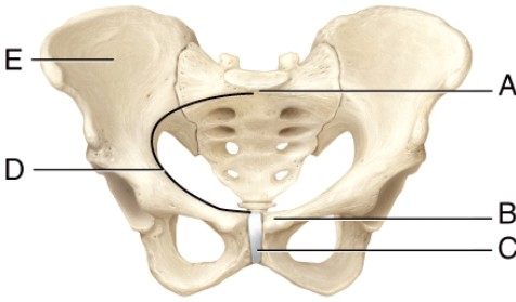 Which structure separates the true pelvis from the false pelvis?