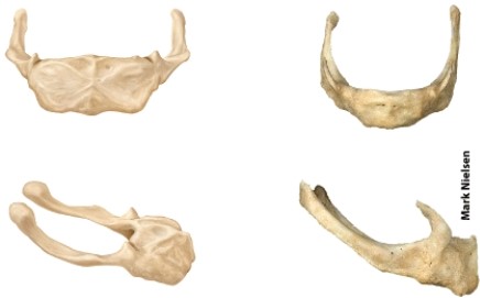 <strong>The illustrated bone is the _____? </strong> A) atlas B) hyoid bone C) axis D) vomer