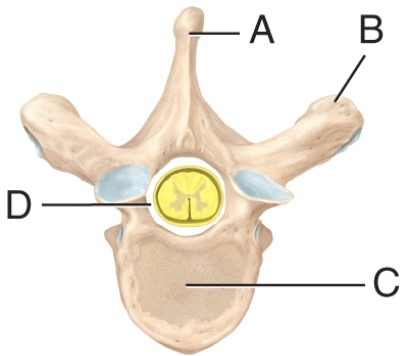 <strong>The label on the transverse process of the vertebra is _____. </strong> A) A B) B C) C D) D
