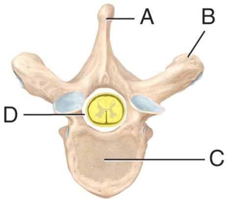 <strong>The label on the spinous process is _____. </strong> A) A B) B C) C D) D