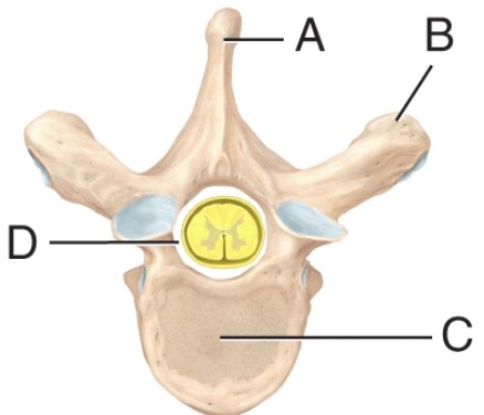 <strong>The label on the vertebral foramen is _____. </strong> A) A B) B C) C D) D