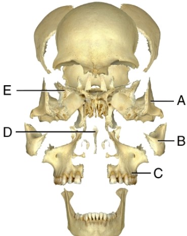<strong>Where is the zygomatic bone? </strong> A) A B) B C) C D) D E) E