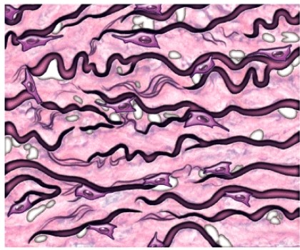 The major fiber type in this tissue is _____.