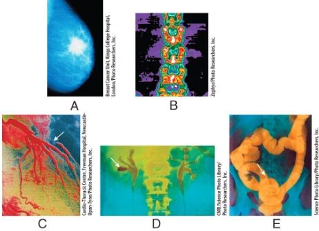 <strong>Which radiographs were obtained using low-dose x-rays? </strong> A)(A)and (B) B)(B)and (C) C)(C)and (D) D)(A)and (C) E)(B)and (E)